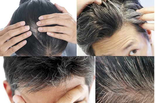 Các biện pháp dưỡng sinh chữa tóc bạc sớm