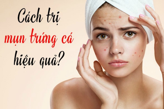 11 Cách Trị Mụn Mụn Trứng Cá Ở Tuổi Dậy Thì