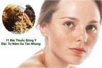 11-bai-thuoc-dong-y-dac-tri-nam-da-tan-nhang