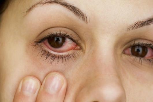 8 Triệu Chứng Giúp Sớm Phát Hiện Các Bệnh Về Mắt
