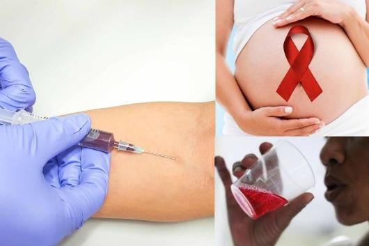 HIV Lây Qua Đường Nào Và Các Biện Pháp Phòng Tránh